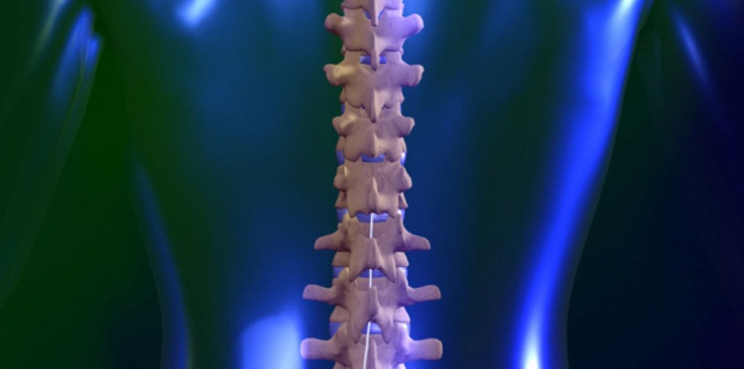 Spinal Cord Stimulation E1418434657458 مجلة نقطة العلمية