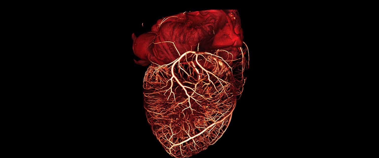 Heart 3D Ct Scan E1451985933214 مجلة نقطة العلمية
