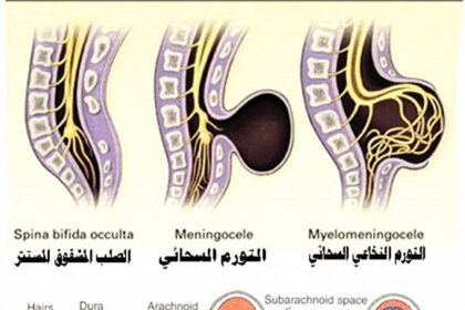 630050546097 حمض الفوليك وصحة الجنين مجلة نقطة العلمية