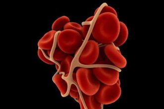 BloodClot نحو الكشف عن تجلط الدم عن طريق تحليل البول مجلة نقطة العلمية