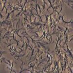 التجمع الذاتي للمانيتول ثنائي الأوكتانات في زيت الكانولا في شبكة بلورية مغلفة الزيت، الأمر الذي يجعله يأخذ بنية شبه صلبة. Credit: George John