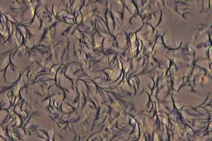 التجمع الذاتي للمانيتول ثنائي الأوكتانات في زيت الكانولا في شبكة بلورية مغلفة الزيت، الأمر الذي يجعله يأخذ بنية شبه صلبة. Credit: George John