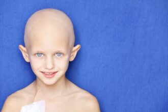 Progeria 3406 l f50e76199c90c71e مرض الشيخوخة الذي يصيب الأطفال مجلة نقطة العلمية
