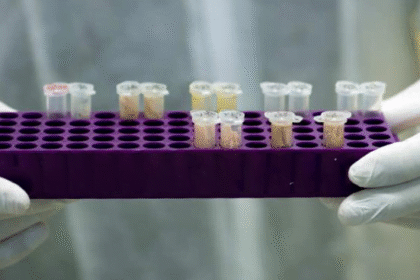 Screen Shot 2014 02 15 at 20.14.58 إنتاج رئة اصطناعية داخل المختبرات الأمريكية مجلة نقطة العلمية