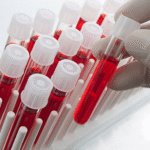 blood دراسة تشير إلى أن الفحوصات التي يطلبها مرضى السرطان غالباً ما تكون صحيحة مجلة نقطة العلمية