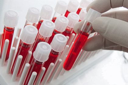 blood دراسة تشير إلى أن الفحوصات التي يطلبها مرضى السرطان غالباً ما تكون صحيحة مجلة نقطة العلمية