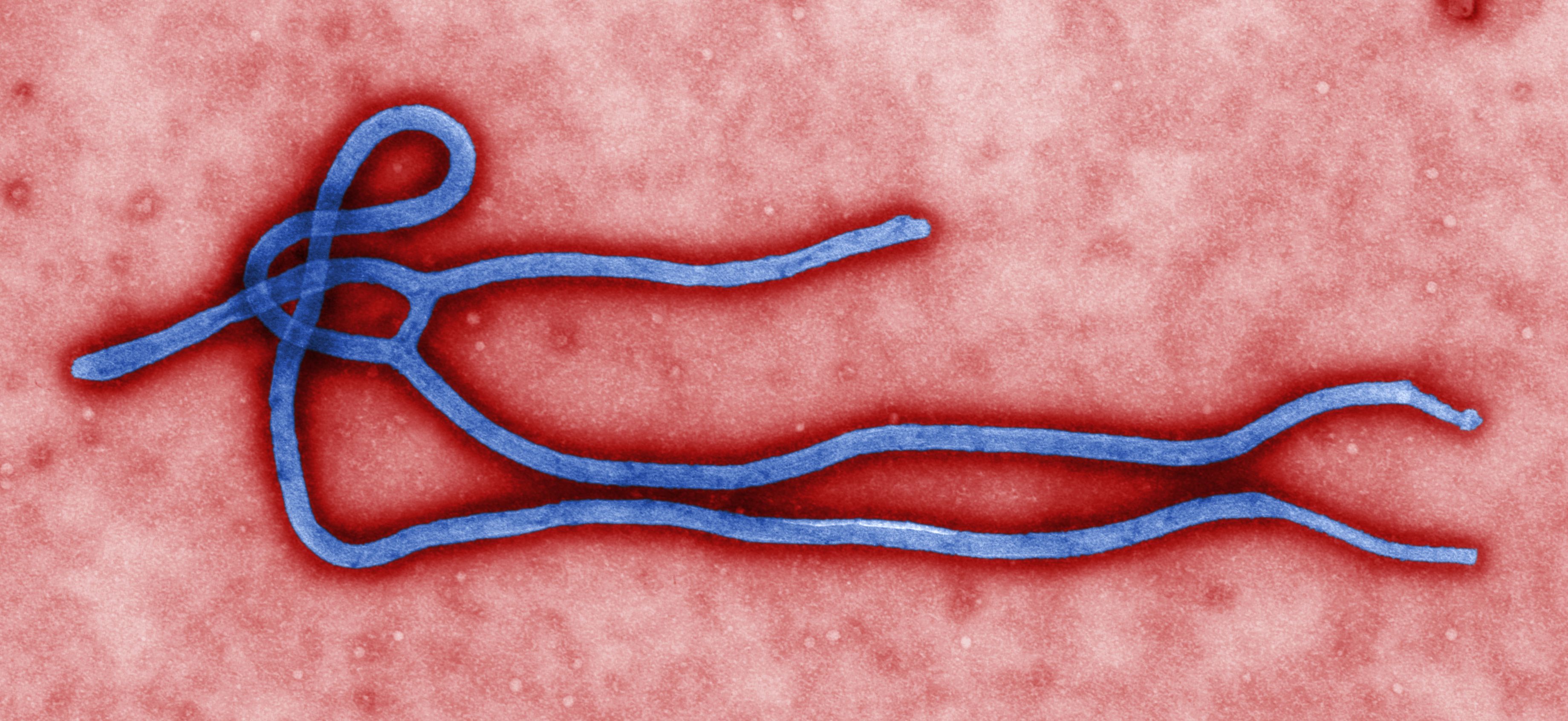Ebola Virus Virion مجلة نقطة العلمية