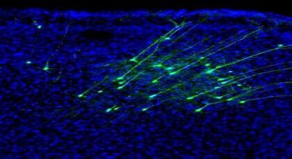 Neurons Project to Auditory Cortex by Anders Nelson Duke University e1409964395685 دراسة : الحركة تؤثر على حاسة السمع مجلة نقطة العلمية