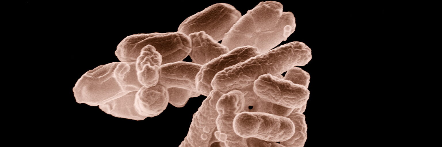 E coli at 10000x original e1413329032716 كبسولة من الفضلات قد تساعد في علاج لتهابات الأمعاء مجلة نقطة العلمية