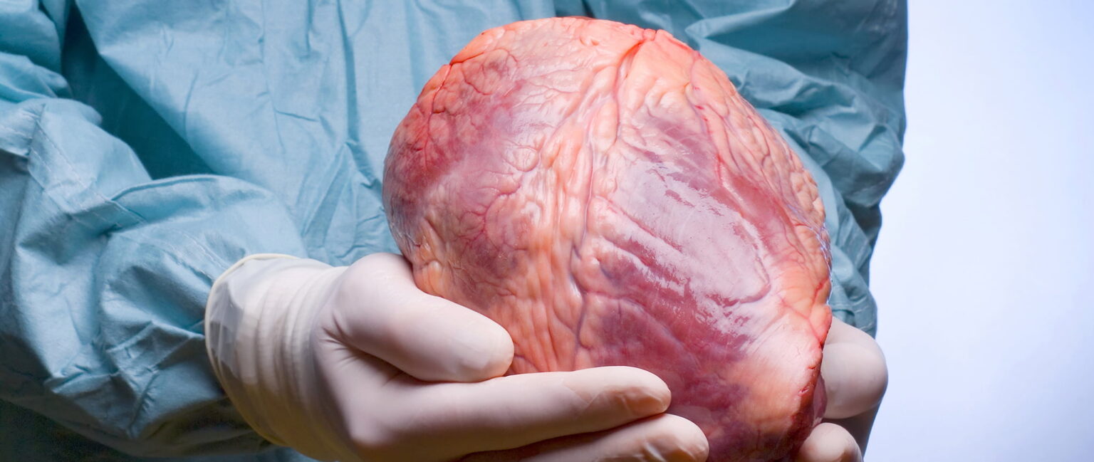 heart e1414487029883 إجراء أول عملية زرع لقلب ميت مجلة نقطة العلمية