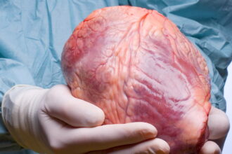 heart e1414487029883 إجراء أول عملية زرع لقلب ميت مجلة نقطة العلمية