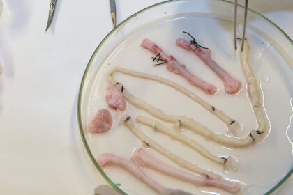 9c3edb381c663d32 org1 e1416354241703 إنماء أوعية دموية جديدة من ملعقتين من الدم مجلة نقطة العلمية