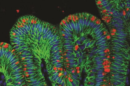 McCracken image6.0.0 cinema 1200.01 e1414889604462 تصنيع معدة بشرية صغيرة من خلايا جذعية مجلة نقطة العلمية