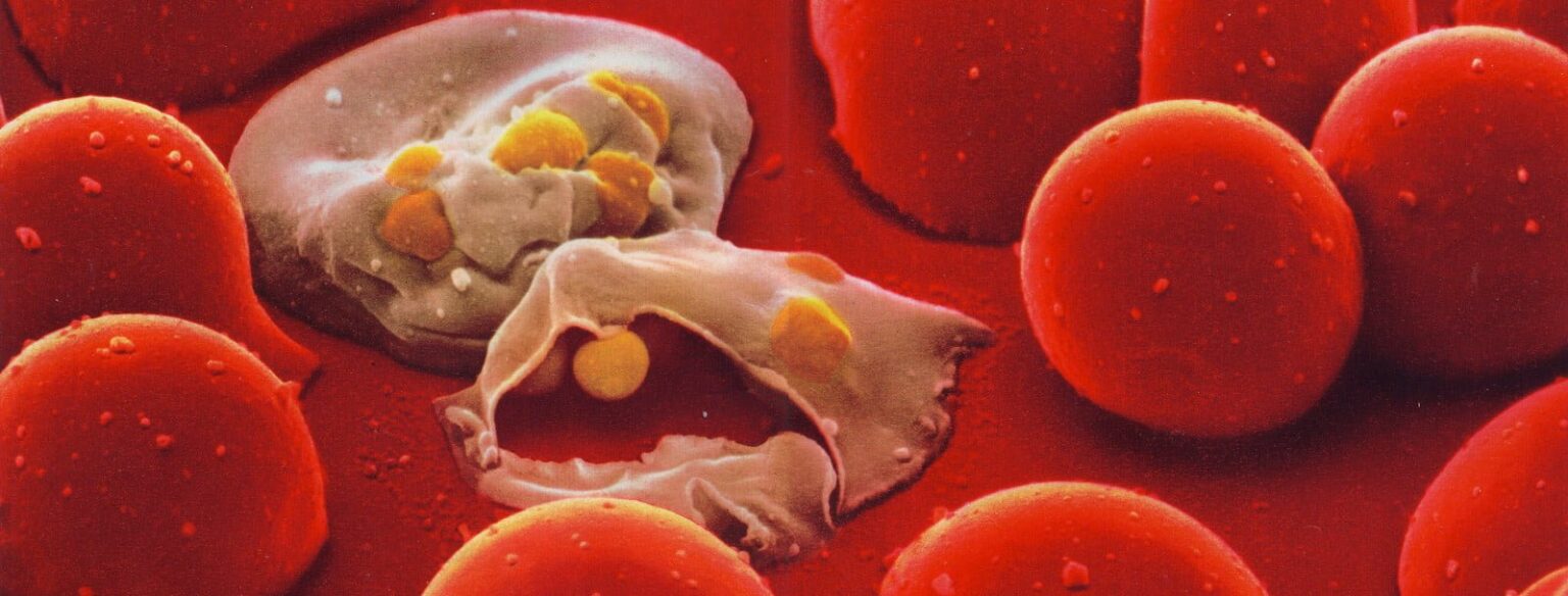 04 on the attack e1419866808713 لماذا يوجد أشخاص لا يصابون بالملاريا مجلة نقطة العلمية