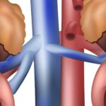 1853 e1418082209291 ما الفرق الذي يحدثه تقليل الملح على الكليتين مجلة نقطة العلمية