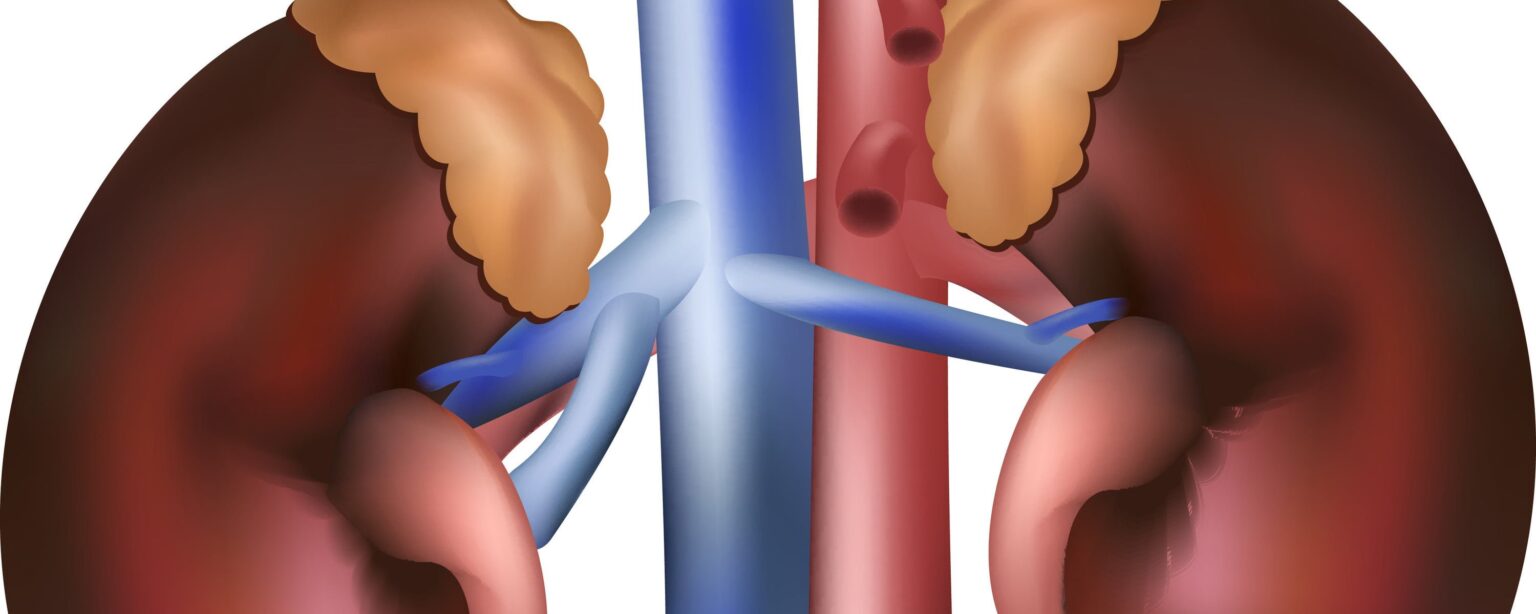 1853 e1418082209291 ما الفرق الذي يحدثه تقليل الملح على الكليتين مجلة نقطة العلمية