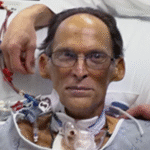 CArig the heartless man 580x281 e1419076835447 شاهد أول رجل في العالم يعيش بلا قلب مجلة نقطة العلمية