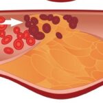 Cholesterol 1024x1024 e1419705086667 دواء يعطى البالغين مستويات الكوليسترول لطفل مجلة نقطة العلمية