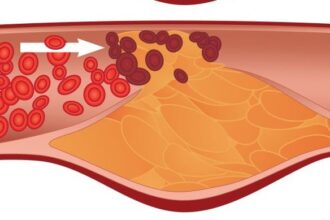 Cholesterol 1024x1024 e1419705086667 دواء يعطى البالغين مستويات الكوليسترول لطفل مجلة نقطة العلمية