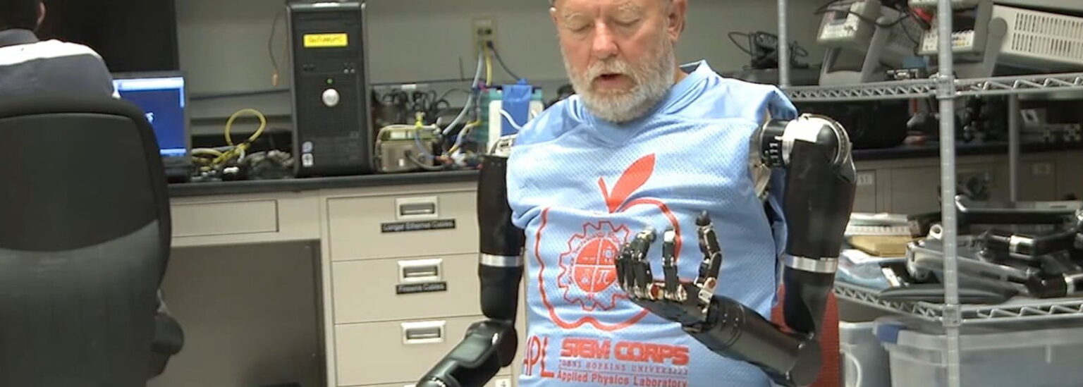 أول رجل يتحكم بطرفين صناعيين بعقله 1 double amputee controls two prosthetic arms just his mind e1419196265368 أول رجل يتحكم بطرفين صناعيين بعقله مجلة نقطة العلمية