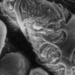 podocyte e1418657097111 تقنية نانوية جديدة تعد بثورة صناعية مختلفة مجلة نقطة العلمية