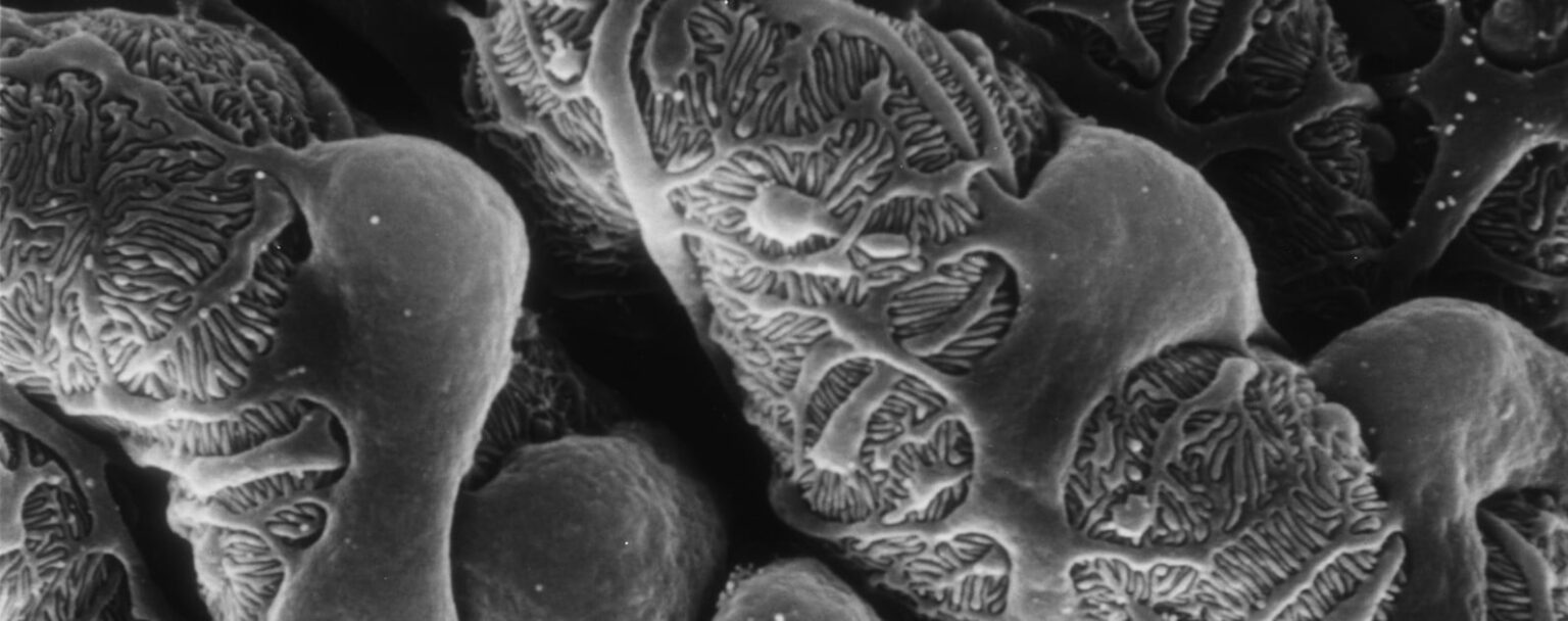 podocyte e1418657097111 تقنية نانوية جديدة تعد بثورة صناعية مختلفة مجلة نقطة العلمية