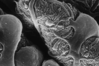 podocyte e1418657097111 تقنية نانوية جديدة تعد بثورة صناعية مختلفة مجلة نقطة العلمية