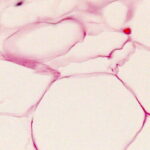 slide 17 40x 141277A621E6E145B13 e1419197910199 الدهون التي يفقدها الجسم تخرج عن طريق الرئتين مجلة نقطة العلمية