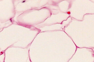slide 17 40x 141277A621E6E145B13 e1419197910199 الدهون التي يفقدها الجسم تخرج عن طريق الرئتين مجلة نقطة العلمية