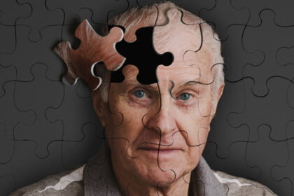 alzheimerrs e1422904331366 أمل جديد باستعادة مرضى الزهايمر لذاكرتهم مجلة نقطة العلمية