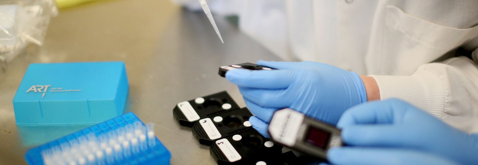 Semen Test May Improve Prostate Cancer Diagnosis e1432131490429 10 أسلحة جديدة لكشف السرطان قبل أن يبدأ هجومه مجلة نقطة العلمية