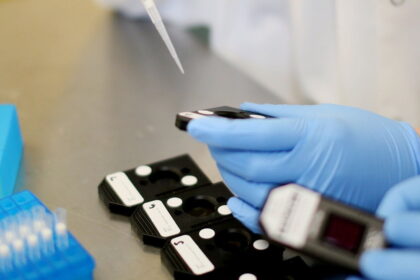 Semen Test May Improve Prostate Cancer Diagnosis e1432131490429 10 أسلحة جديدة لكشف السرطان قبل أن يبدأ هجومه مجلة نقطة العلمية