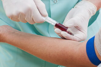 blood test e1432329112648 اختبار جديد للدم قادر على اكتشاف السرطان مجلة نقطة العلمية
