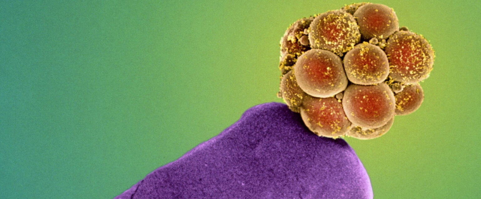 embryo crispr 009 e1431378260804 ما هي آفاق علاج البشر عن طريق تعديل الحمض النووي مجلة نقطة العلمية