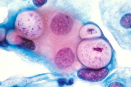 3360002123 e27d75a2f8 o.0.0 e1433881880565 هل يجب على النساء إجراء فحص سرطان عنق الرحم سنوياً ؟ مجلة نقطة العلمية