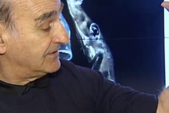 ear arm e1439973784442 رجل يزرع أذناً ثالثة على ذراعه متصلة بالإنترنت مجلة نقطة العلمية