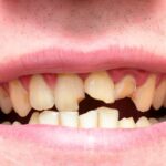 o YELLOW TEETH facebook كيف تتحول الأسنان إلى اللون الأصفر مجلة نقطة العلمية