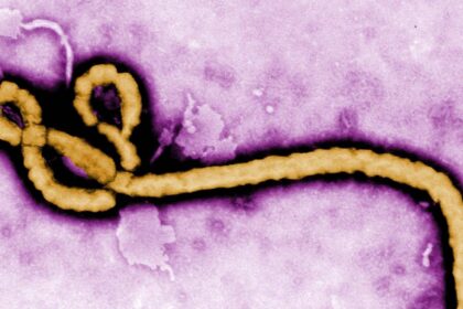 ebola virus 2 e1461753404761 اختبار جديد قادر على كشف جميع الفيروسات التي تصيب البشر مجلة نقطة العلمية