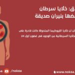 لوكيميا علاج لا يصدق: خلايا سرطان الدم تقتل بعضها بنيران صديقة مجلة نقطة العلمية