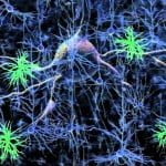 maxresdefault 1 e1459169722666 خلية دهنية متسللة تكشف أورام المخ الخفية مجلة نقطة العلمية