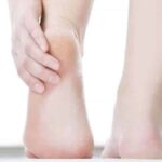 Cracked heels dollar paid e1539519253466 تَعرَّف إلى أسباب تشقق القدمين مجلة نقطة العلمية