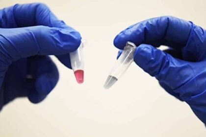 Color Changing Cancer Detection University of Queensland e1545080556919 تقنية حديثة يمكنها الكشف عن جميع أنواع السرطانات في 10 دقائق مجلة نقطة العلمية