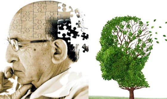 Alzheimer مجلة نقطة العلمية