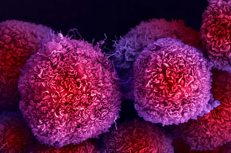 C0487293 Pancreatic Cancer Cells Sem Web مجلة نقطة العلمية