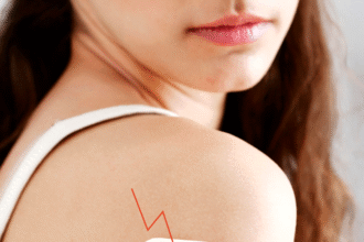 birth control patch 1611778680 هل تفكرين في الحصول على رقعة تنظيم النسل؟ إليك كل ما تريدين أن تعرفيه عنها مجلة نقطة العلمية