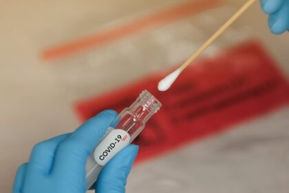 corona test 01 فحص كورونا مزور يباع في عدة دول .. هذا كل ما تحتاجه للمرور بين المطارات مجلة نقطة العلمية