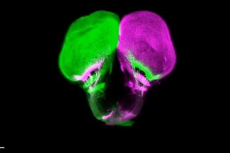 Gar Brain 777x437 1 اكتشاف يعيد كتابة "التاريخ التطوري" مجلة نقطة العلمية