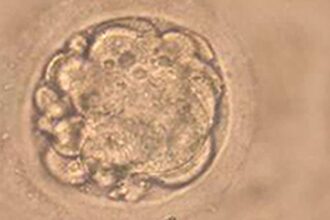 R40IO34LConxNZ3cnwwV علماء يبتكرون أجنة هجينة بين الإنسان والقرد مجلة نقطة العلمية