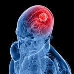 drugs brain tumors أمل جديد لمرضى سرطان الدماغ..هياكل يمكن أن تساعد على محاربة الأورام مجلة نقطة العلمية