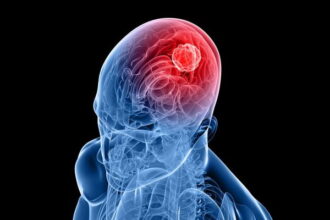 drugs brain tumors أمل جديد لمرضى سرطان الدماغ..هياكل يمكن أن تساعد على محاربة الأورام مجلة نقطة العلمية
